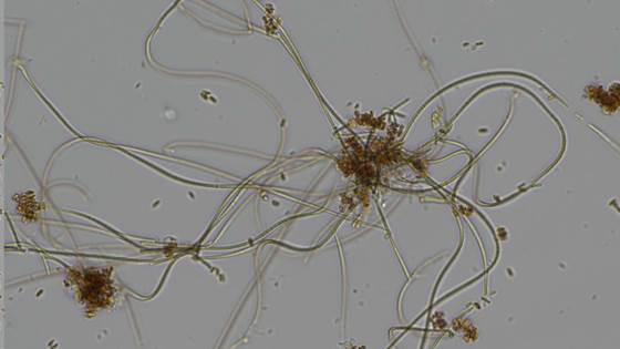 Wasteless 2.0 - Sekundær behandling av RAS-vann og næringsstoff-revalorisering ved stedsspesifikk mikrobiell biofilm