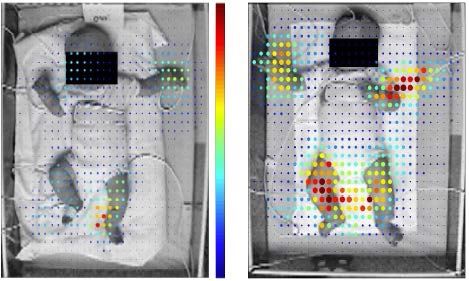 Robotsyn kan brukes til å lese spedbarns bevegelser for å finne ut om de er rammet av cerebral parese (CP). Foto: NTNU, St. Olavs Hospital