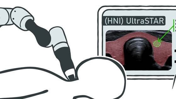 Robot-assisted ultrasound examination of thyroid nodules — (HNI) UltraSTAR